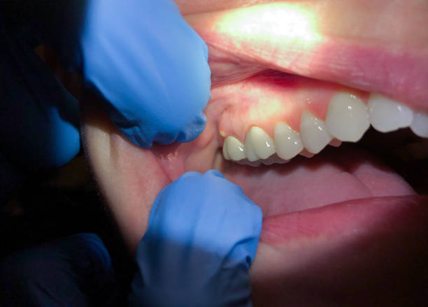 Best Cosmetic Emergency Dentistry in Georgetown, KY